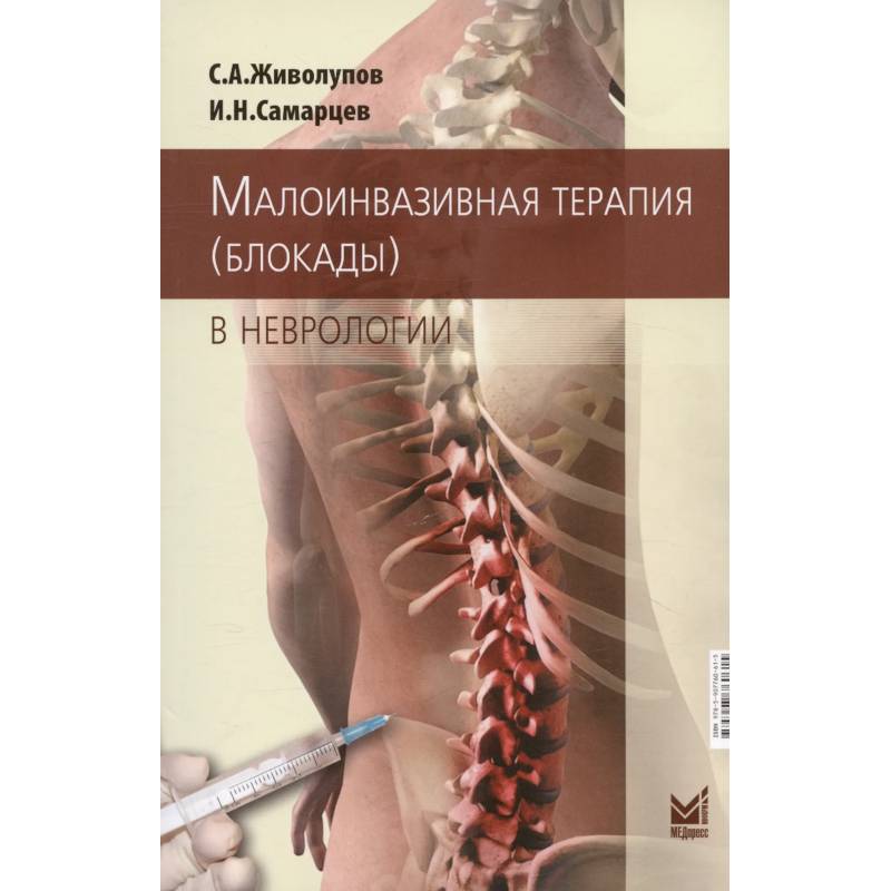 Малоинвазивная терапия (блокады) в неврологии