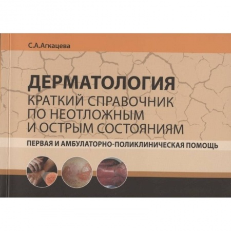 Медицинские энциклопедии и справочники, книга Дерматология. Краткий справочник по неотложным и острым состояниям купить по скидке