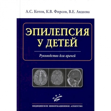 Неврология, книга Эпилепсия у детей. Руководство для врачей купить по скидке