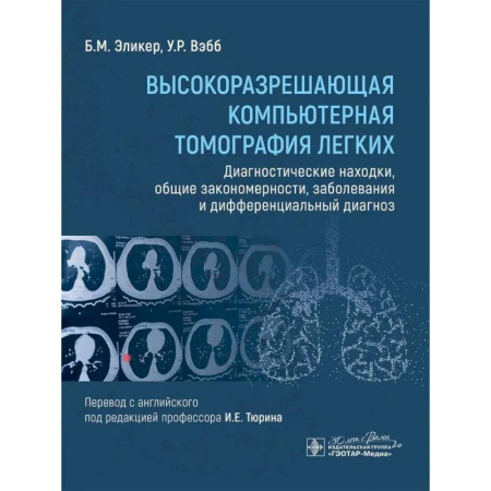 Медицинские энциклопедии и справочники, книга Высокоразрешающая компьютерная томография легких. Диагностические находки, общие закономерности, заболевания и дифференциальный диагноз купить по скидке