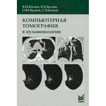 Компьютерная томография в пульмонологии