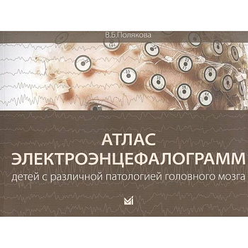 Атлас электроэнцефалограмм детей с различной патологией головного мозга