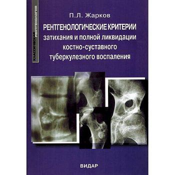 Рентгенологические критерии затихания и полной ликвидации костно-суставного туберкулезного воспаления