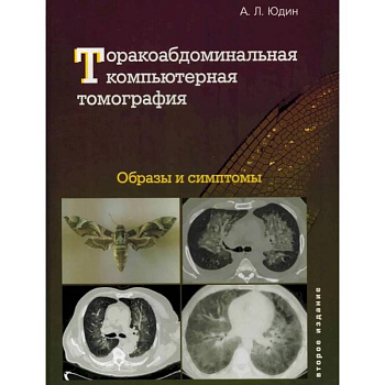Торакоабдоминальная компьютерная томография. Образы и симптомы